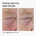 ord-caffeine-solution-egcg-dark-circles-before-after.webp