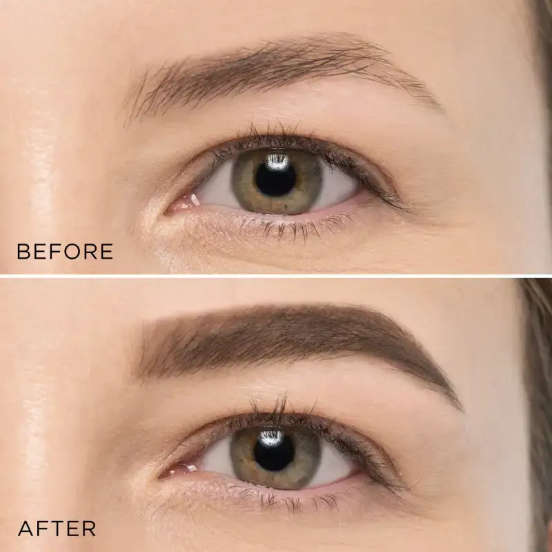 media_before_after_en_imported (1).webp