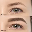 media_before_after_en_imported (1).webp