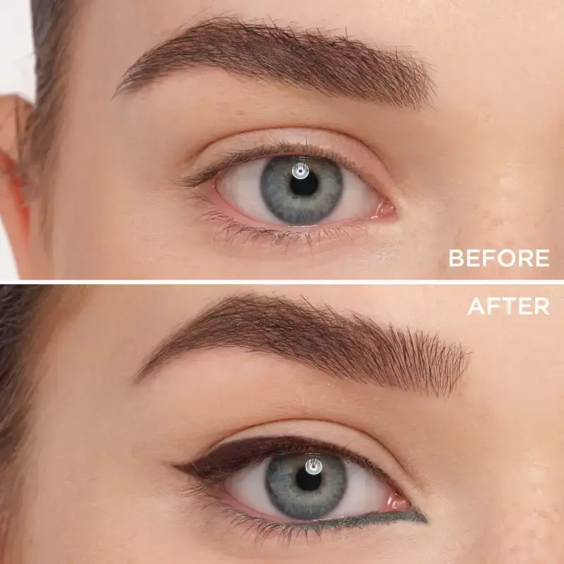 media_before_after_en_imported (4).webp