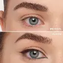 media_before_after_en_imported (4).webp