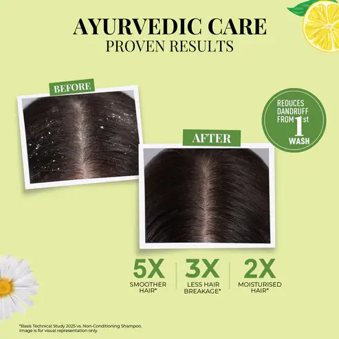 Anti-DandruffshampooPDP_6.webp
