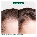 3  FullRescue_PDPresize_BeforeAfter_700x700_JULIA1.webp
