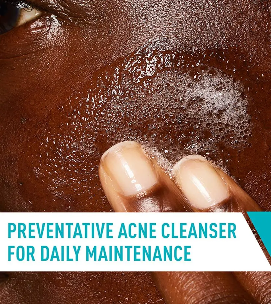 Acne-Control-Cleanser-apply-desktop-700x785-v1.webp