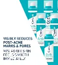 retinol-results-desktop-700x785-v1.webp